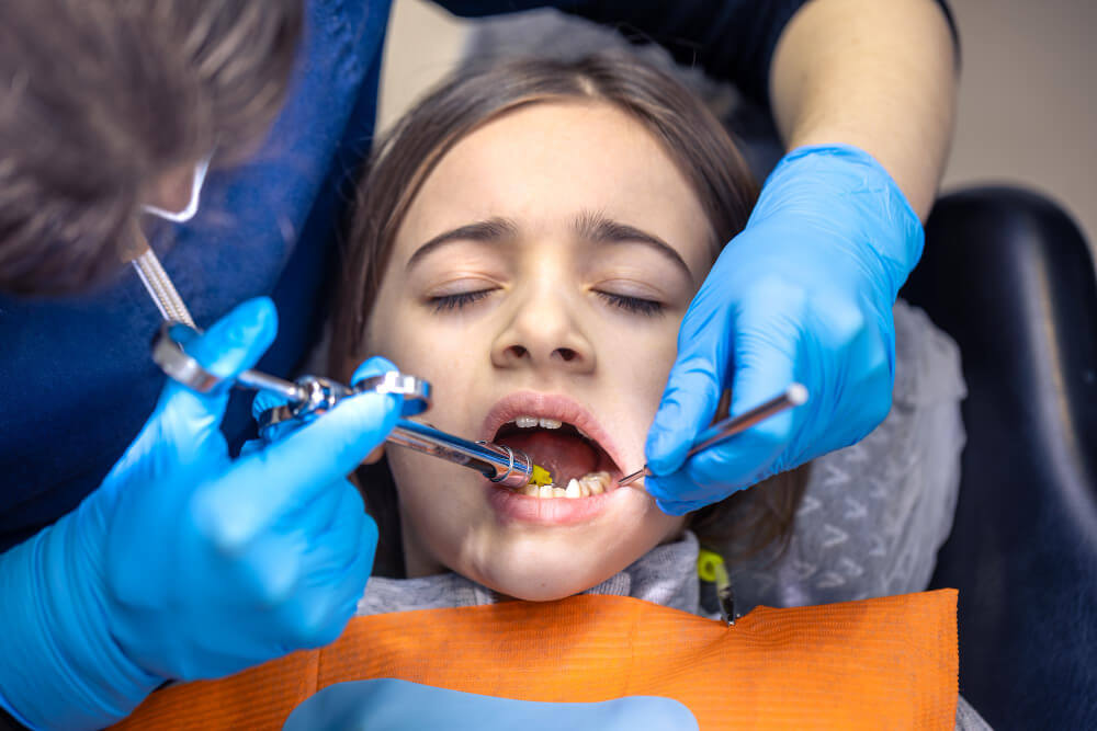 Cracked Tooth Repair