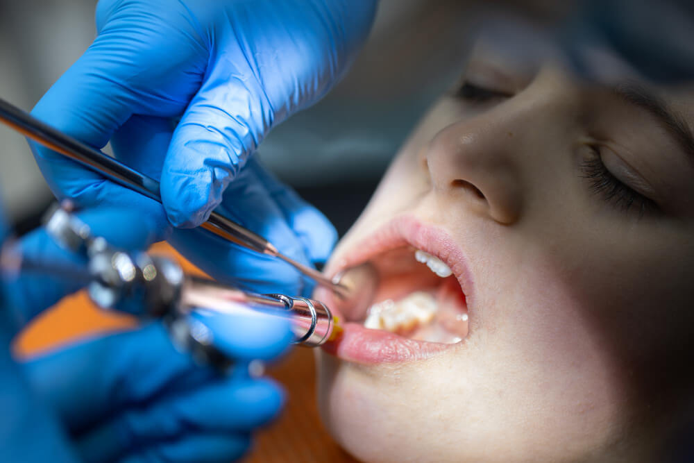 Surgical Tooth Removal